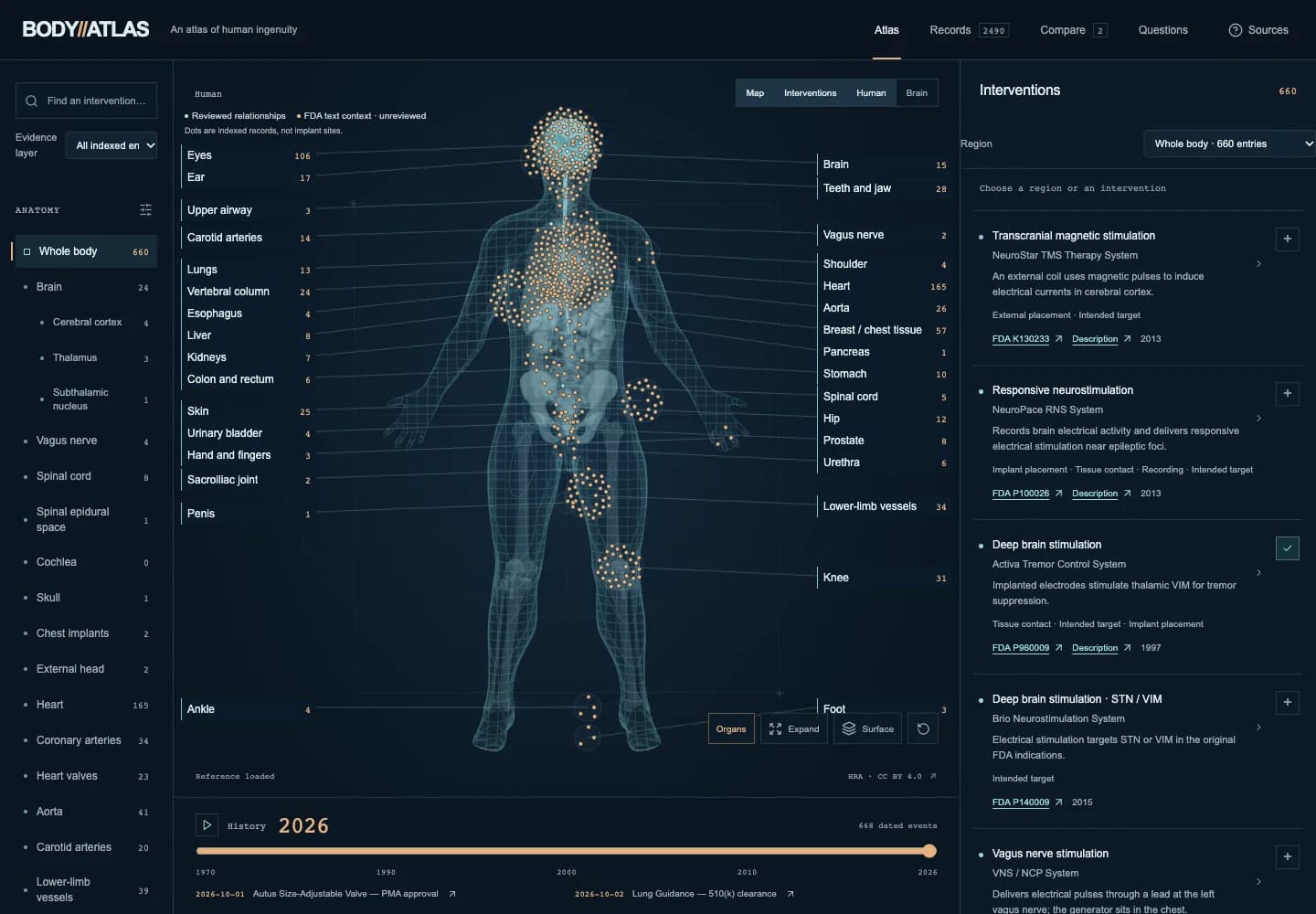 Actual BODY//ATLAS prototype showing regional intervention records on a human anatomical reference with an evidence panel
